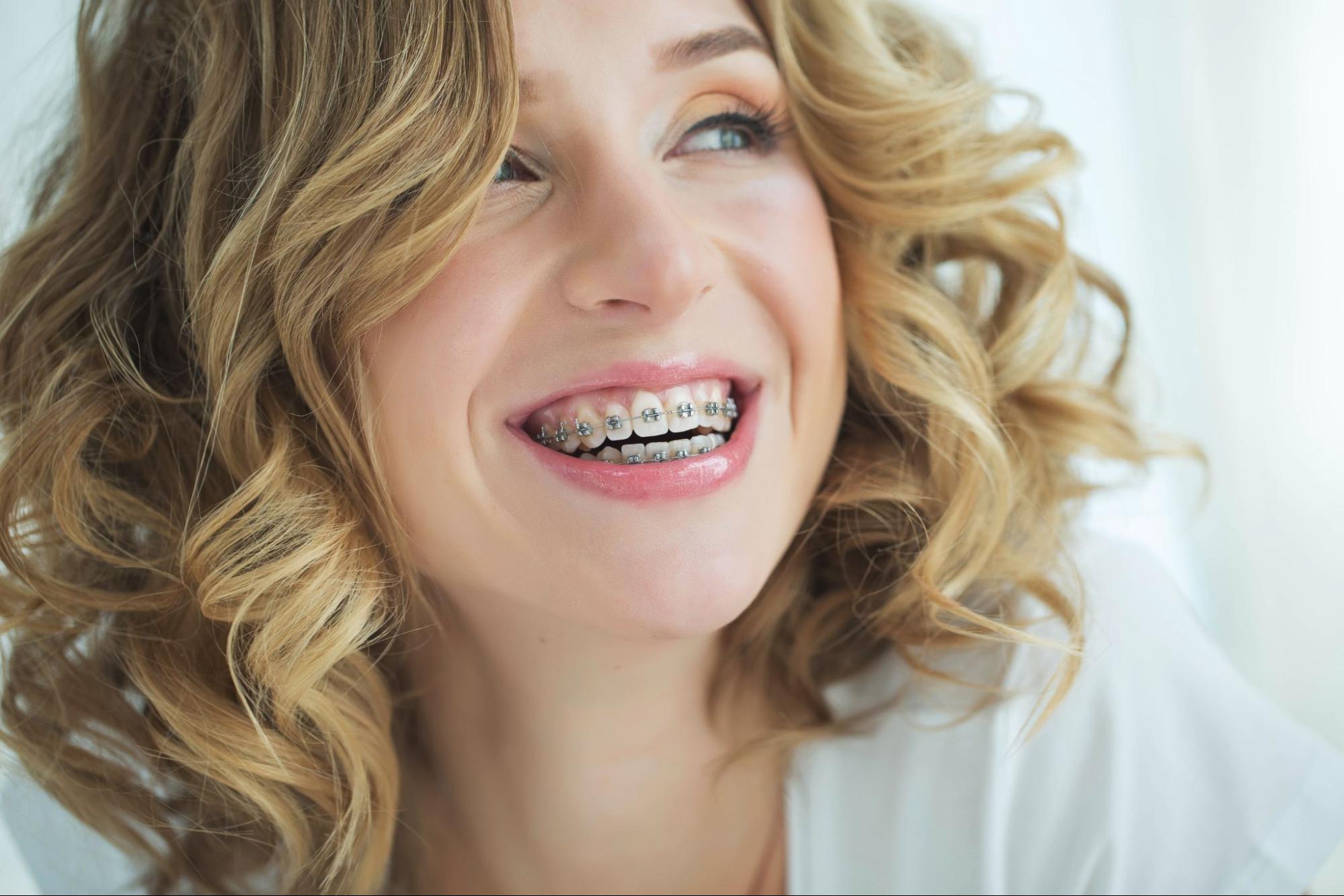 Should I Choose Braces or Clear Aligners?
