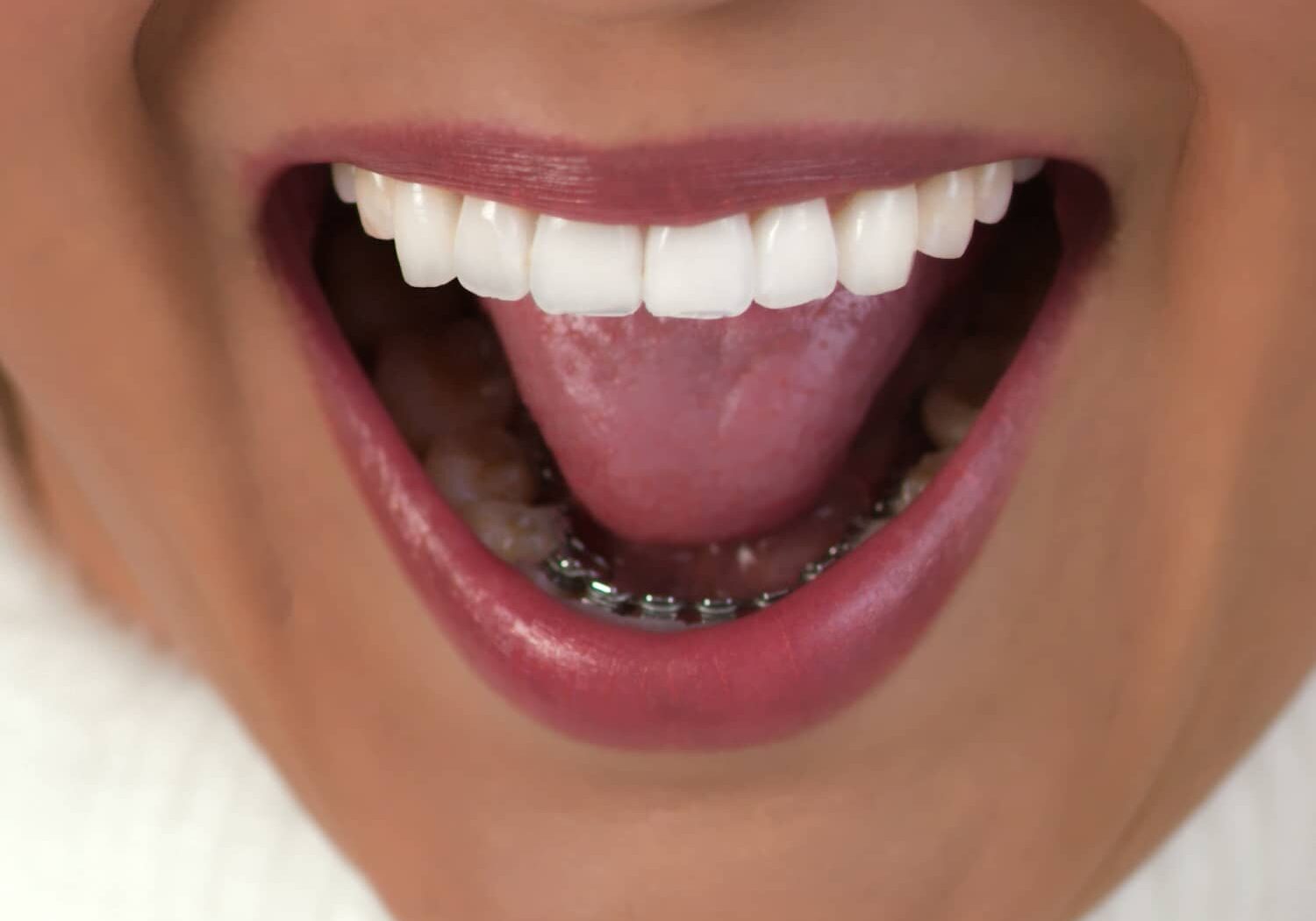 Invisalign Glendale